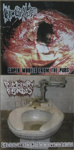 Pulmonary Fibrosis : Pulmonary Fibrosis - Incurable